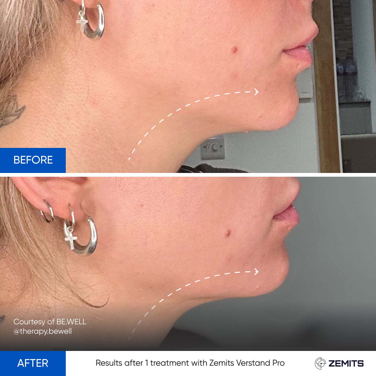 Before After Slide 4