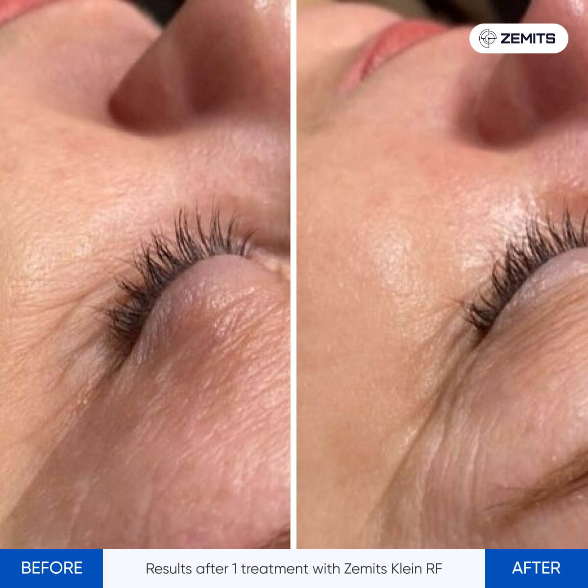 Before After Slide 9