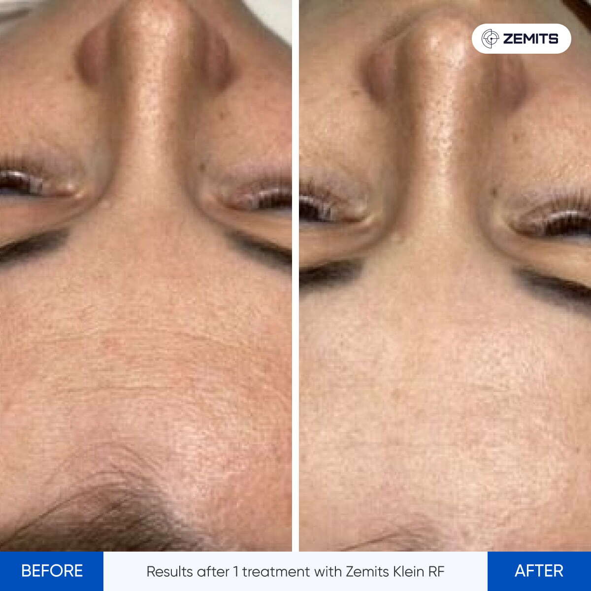 Before After Slide 10