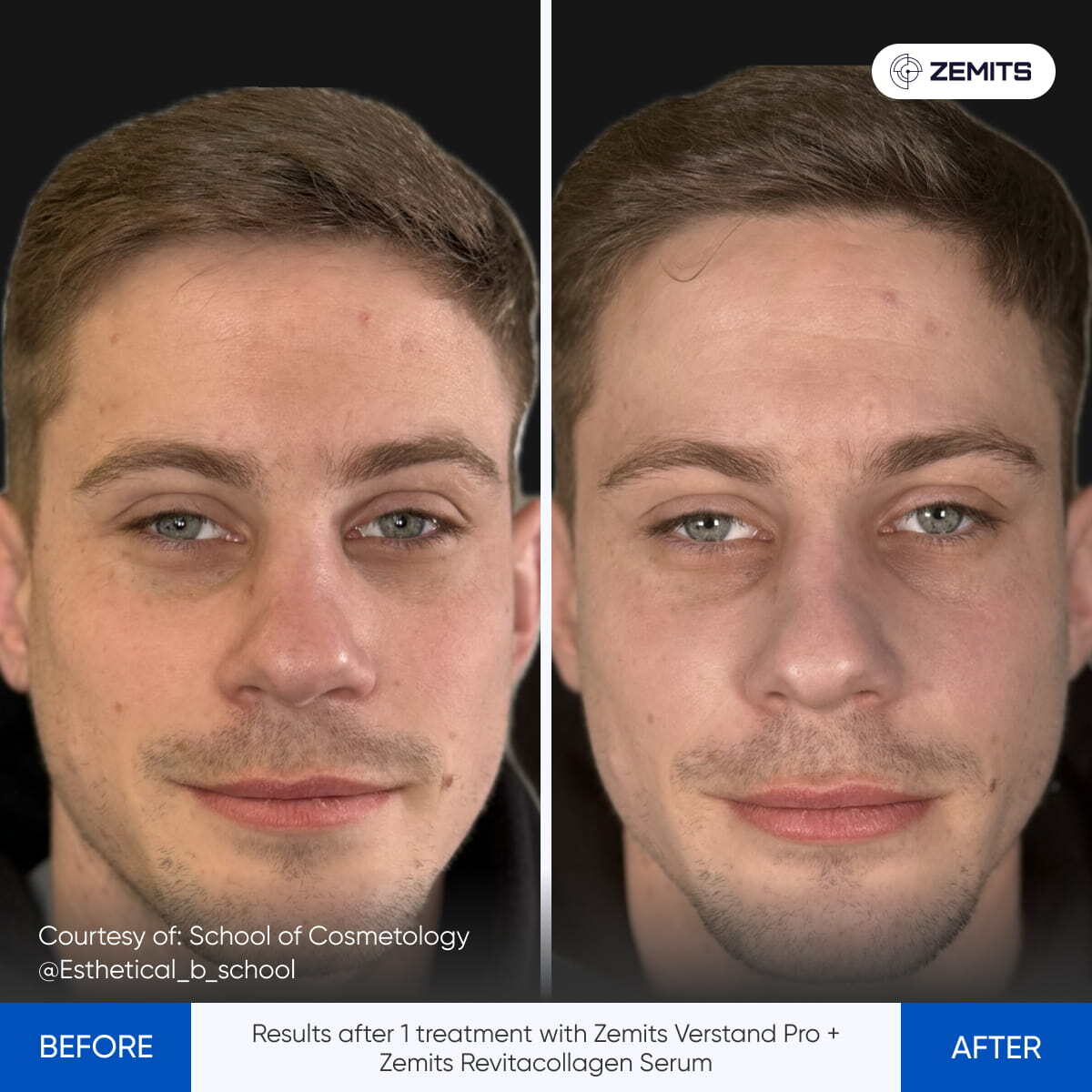 Before After Slide 5