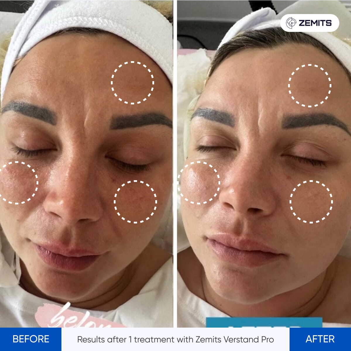 Before After Slide 1