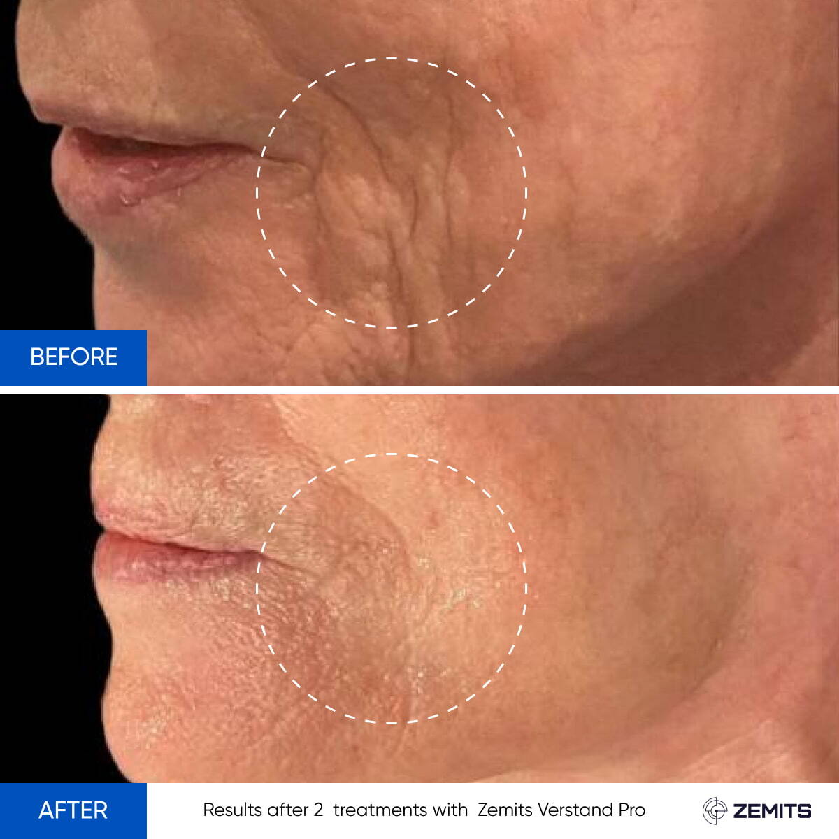 Before After Slide 5