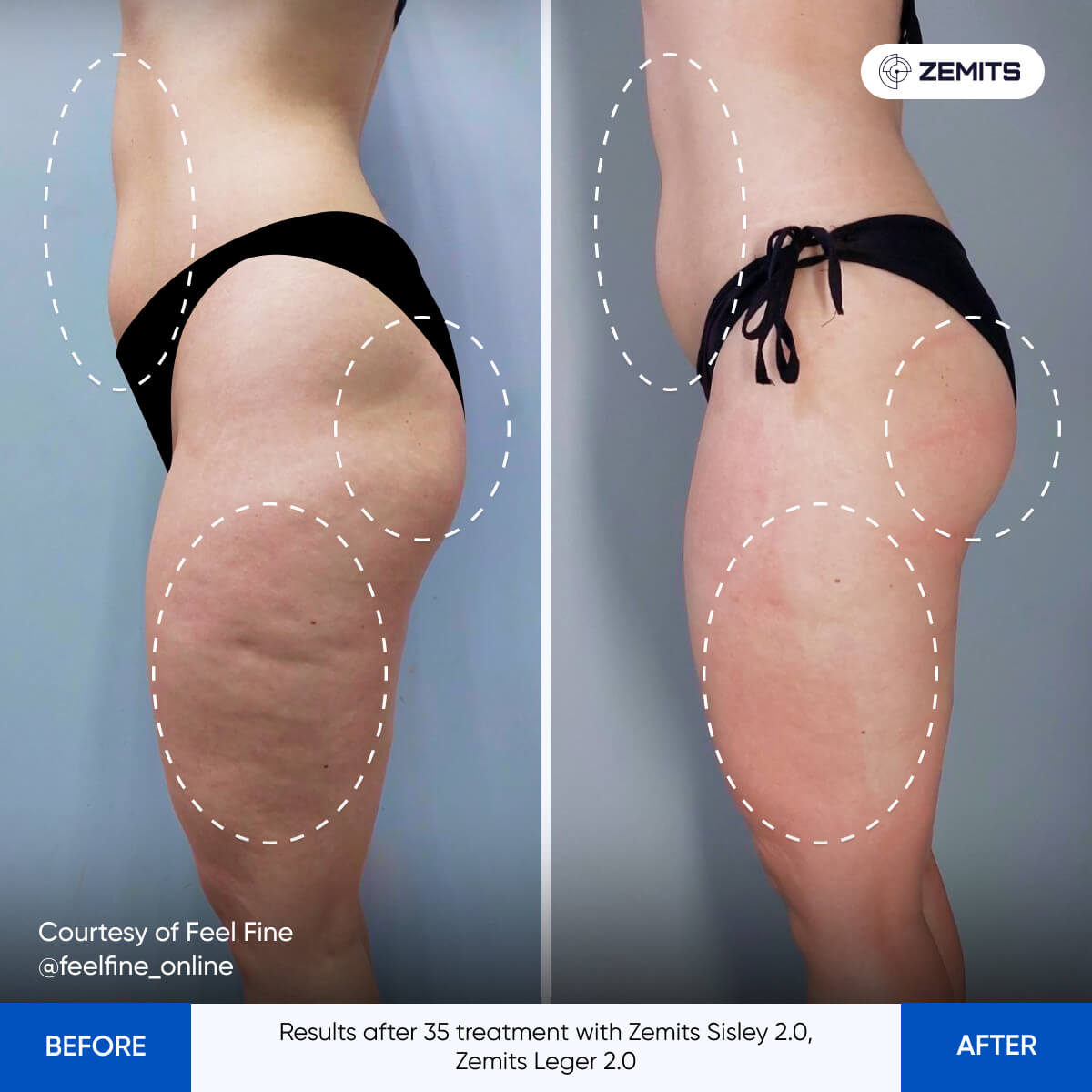 Before After Slide 5