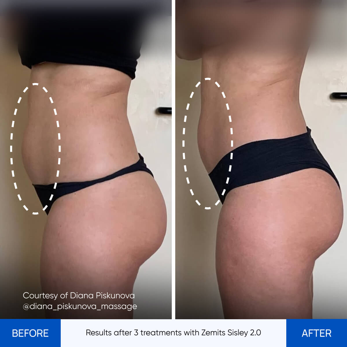 Before After Slide 2