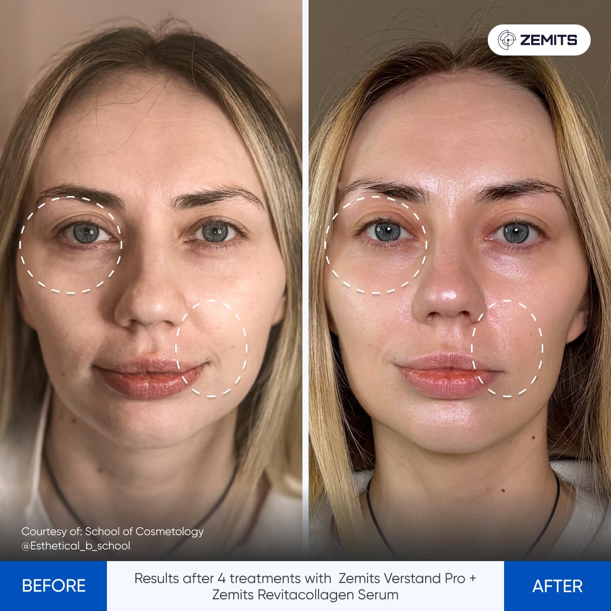 Before After Slide 6