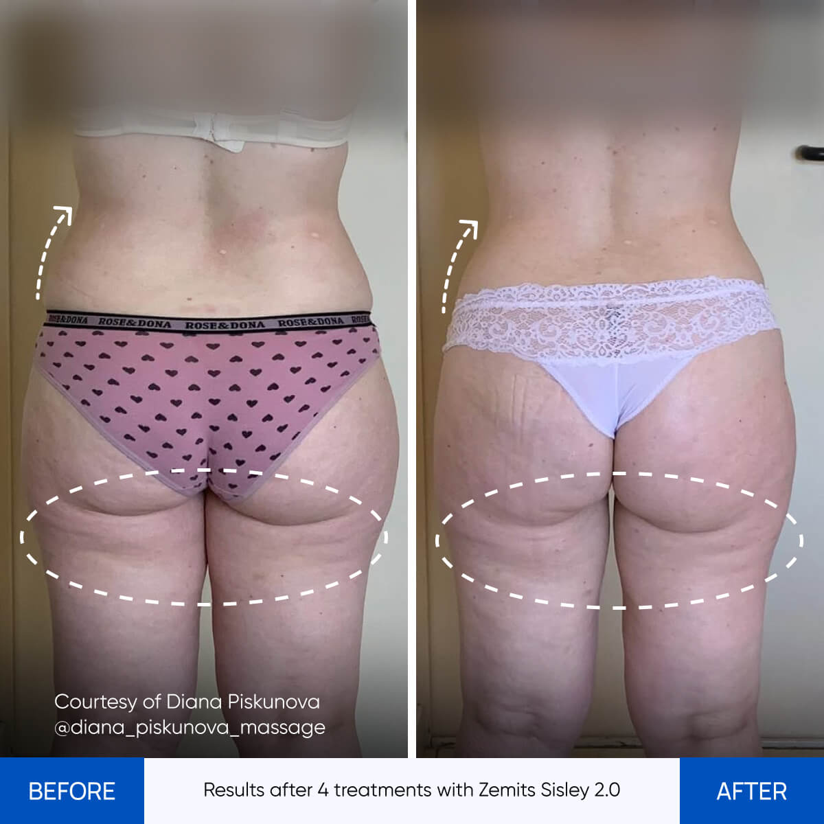 Before After Slide 6