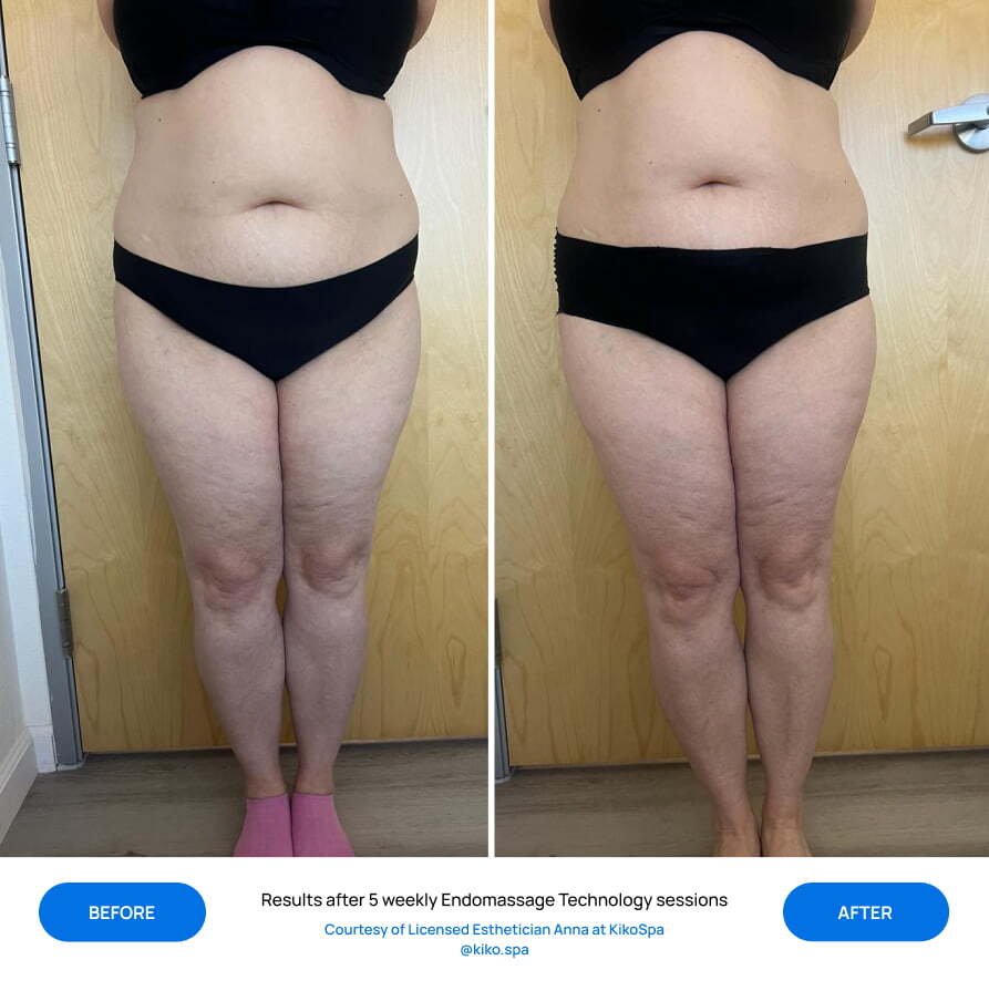 Before After Slide 2