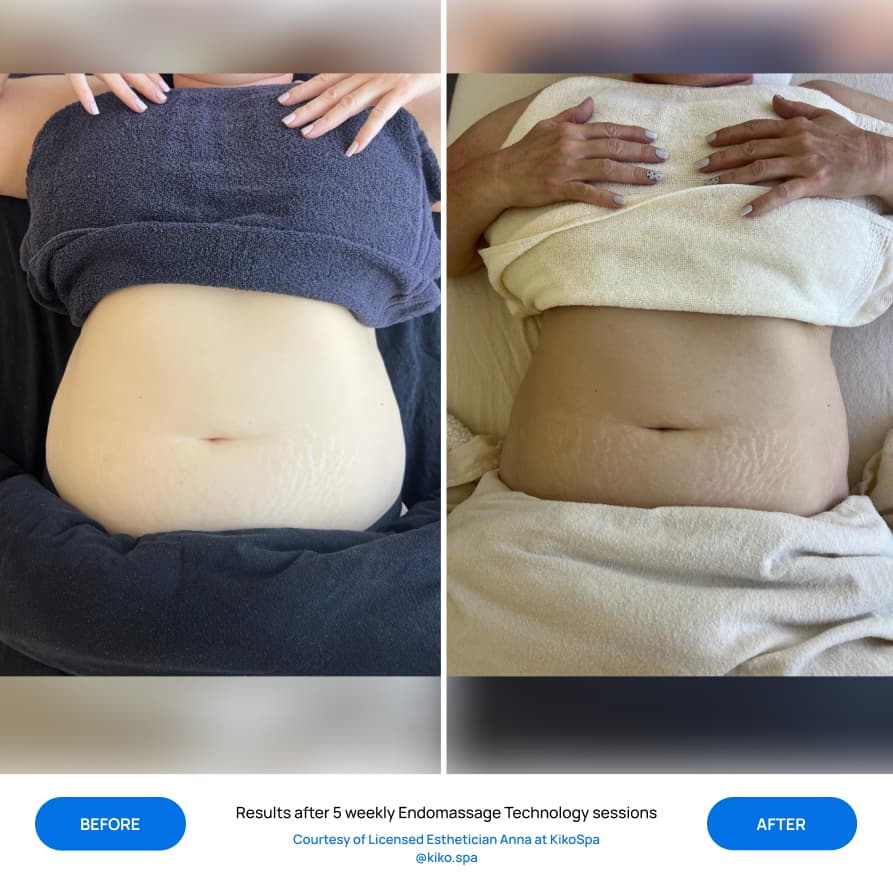 Before After Slide 3