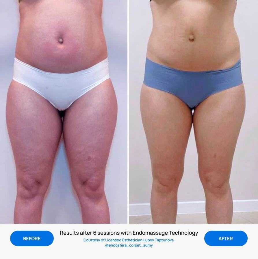 Before After Slide 6
