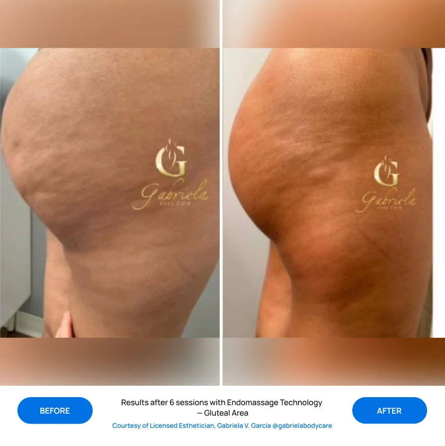 Before After Slide 1