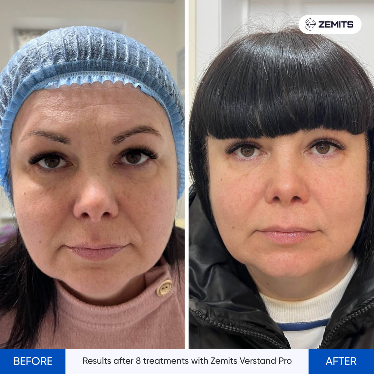 Before After Slide 7