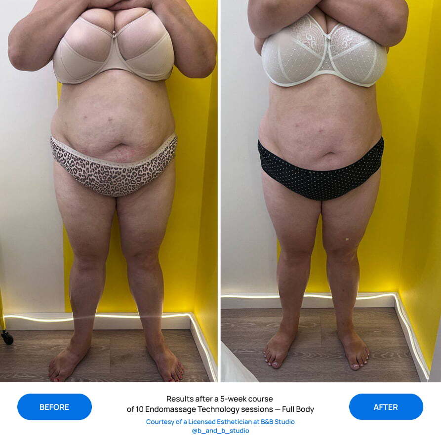 Before After Slide 1