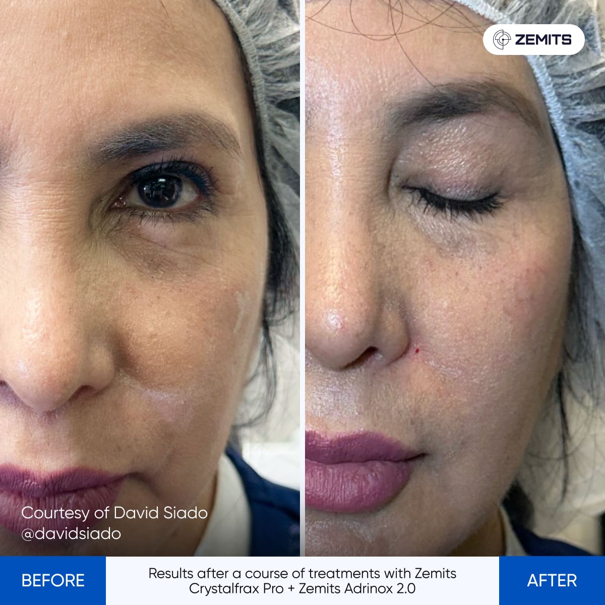 Before After Slide 5