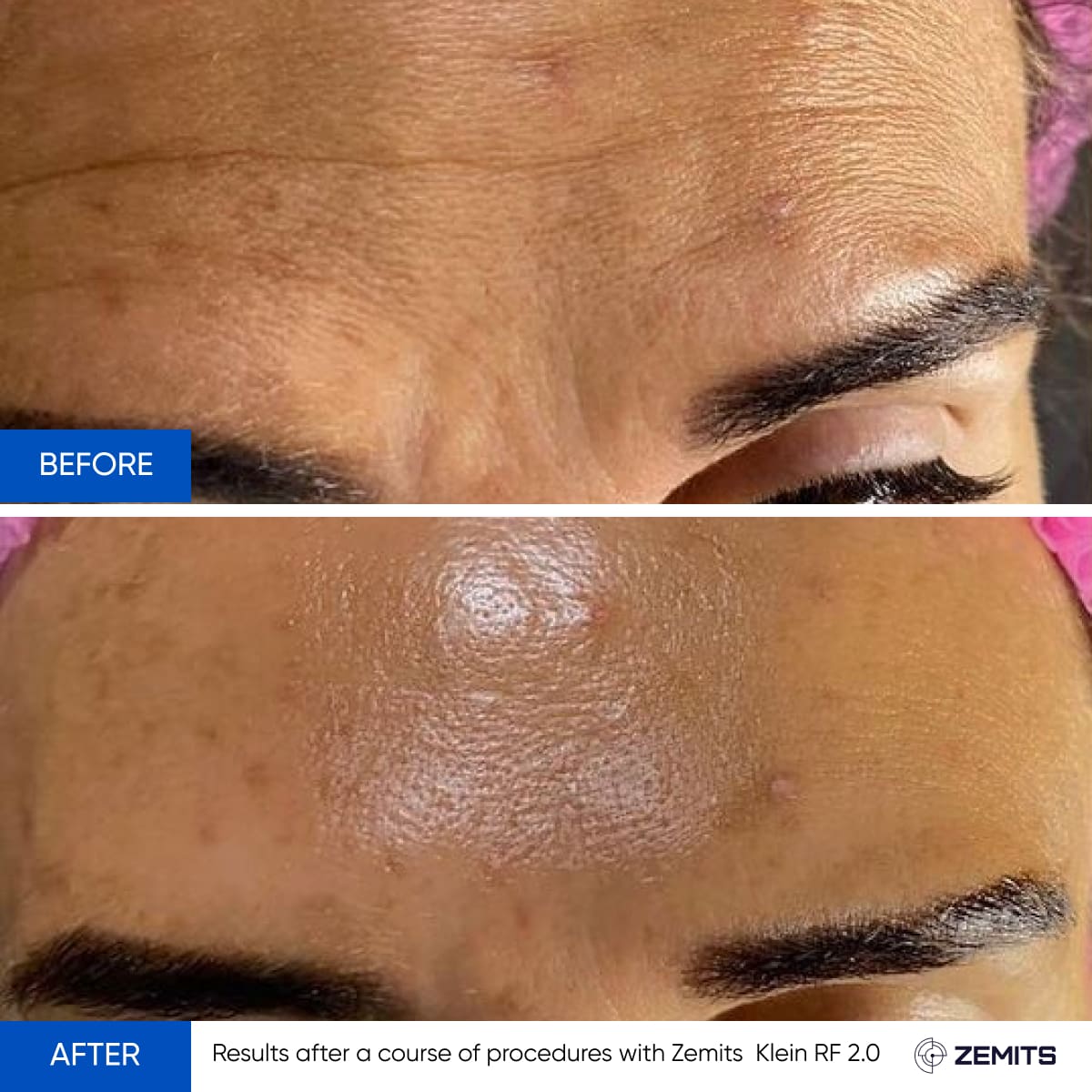 Before After Slide 17