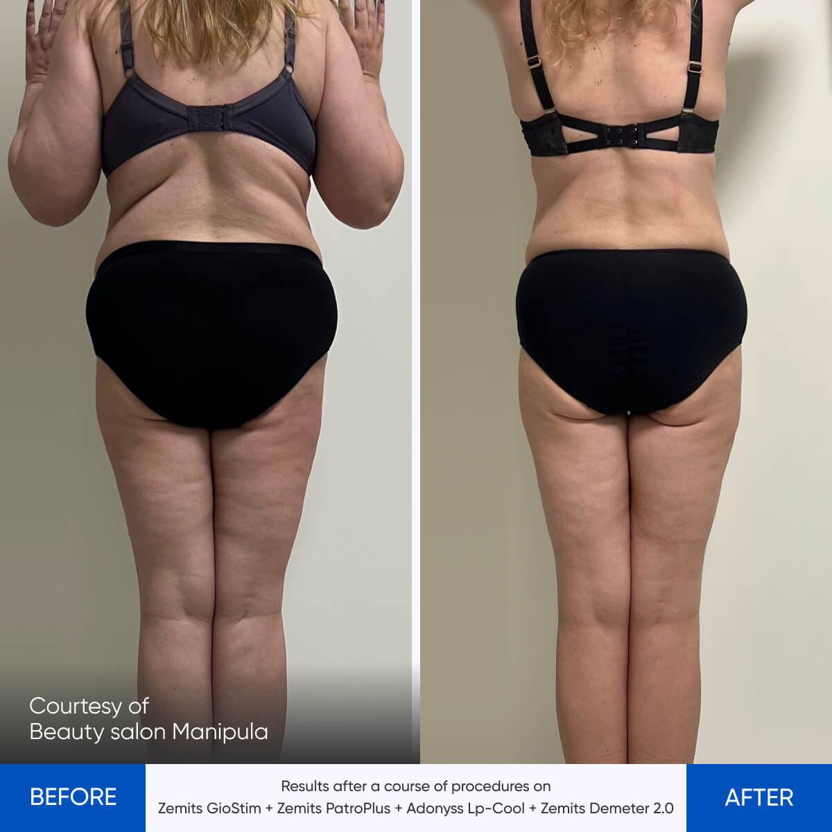Before After Slide 7