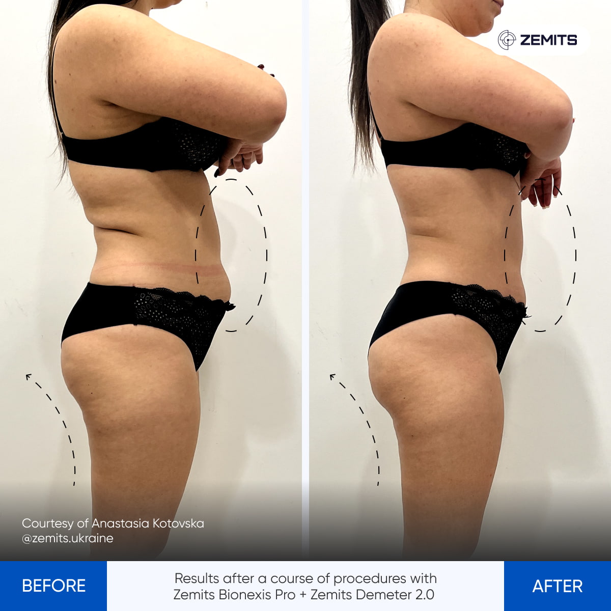 Before After Slide 8