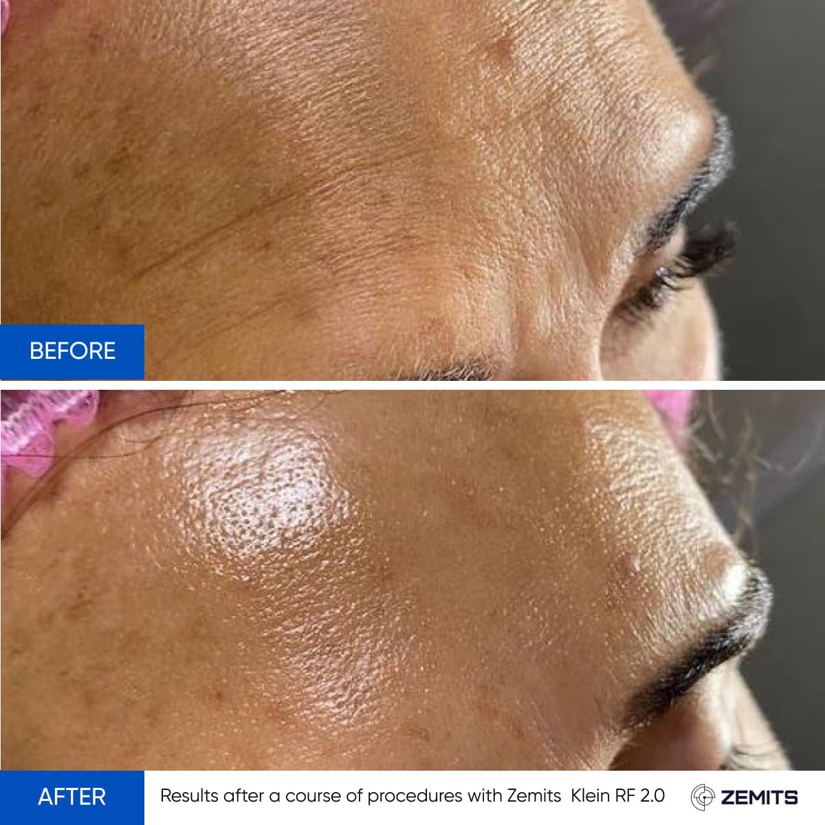 Before After Slide 2