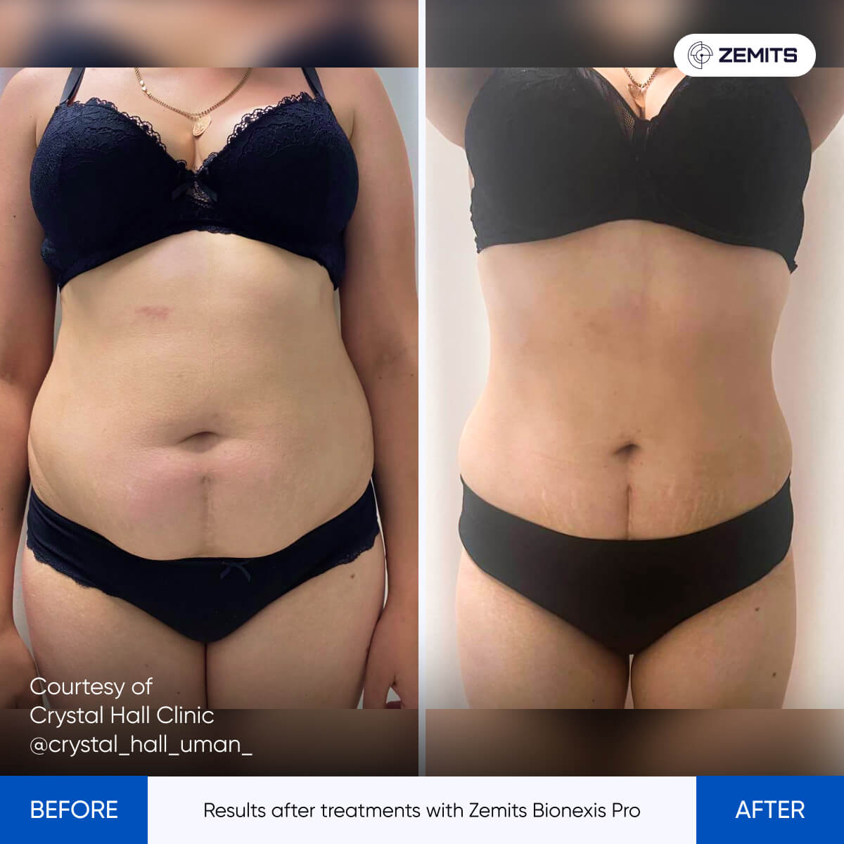 Before After Slide 2