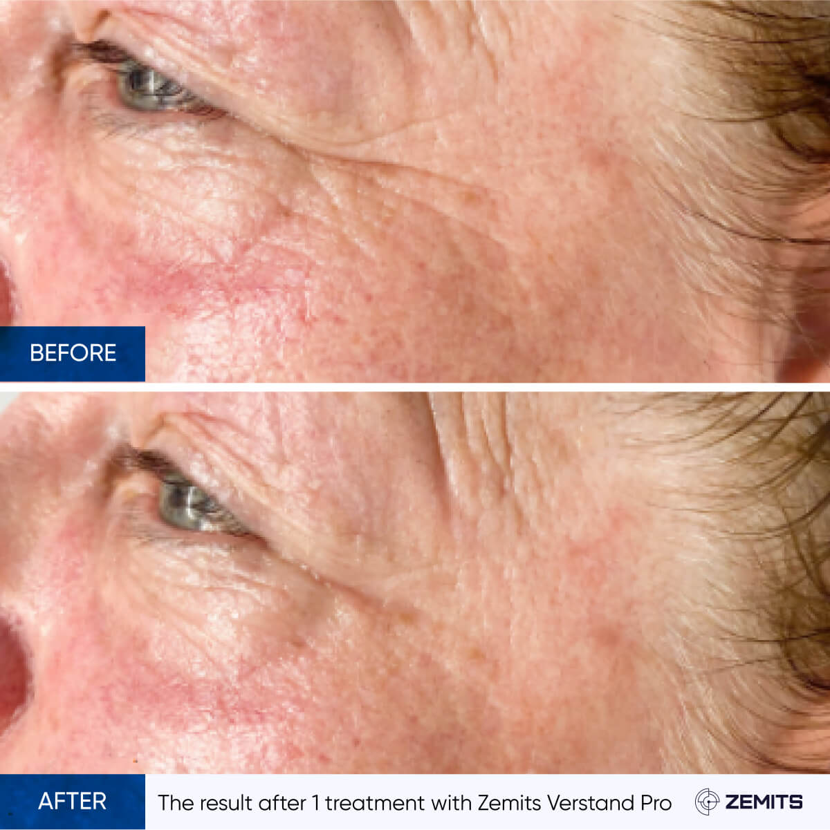 Before After Slide 10