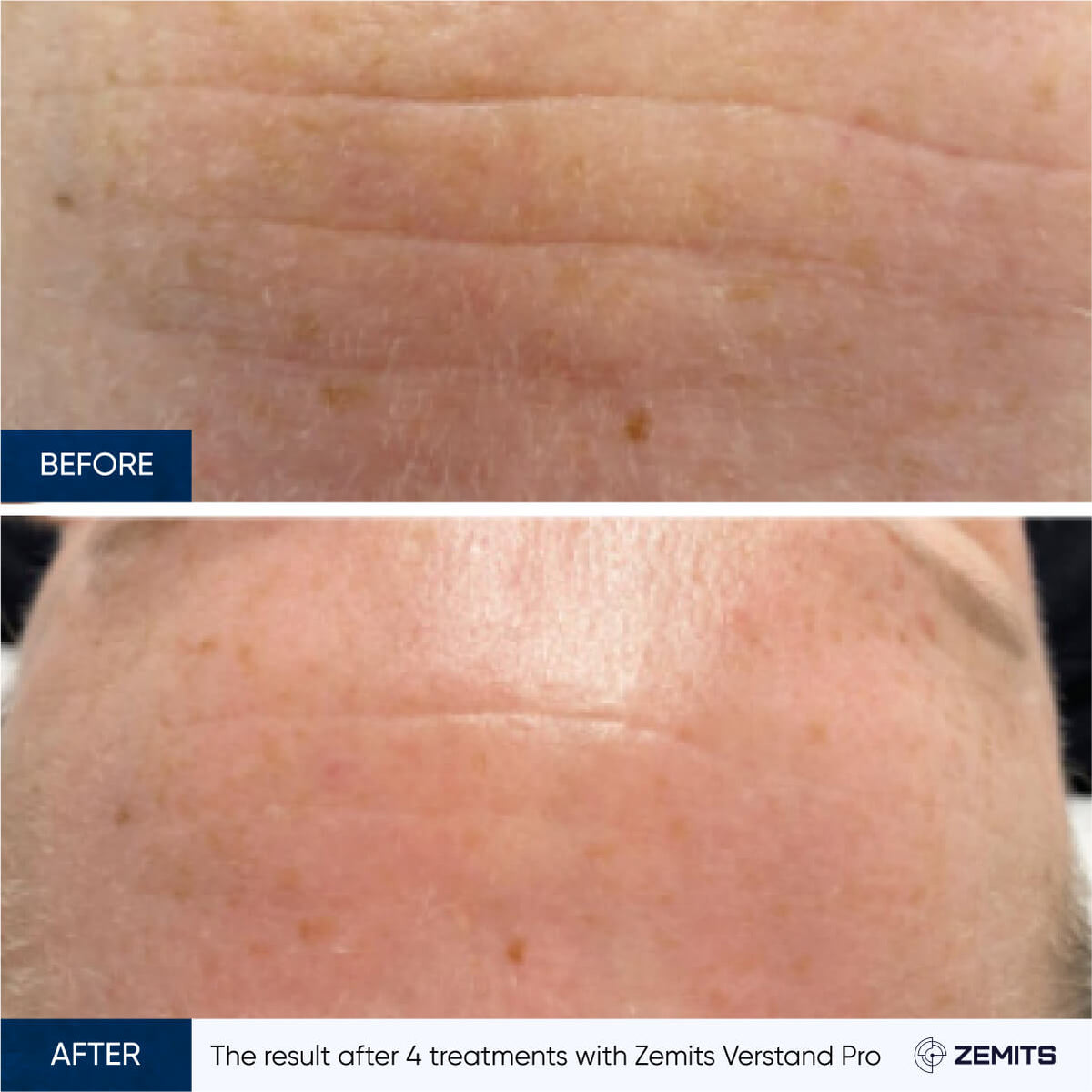 Before After Slide 13