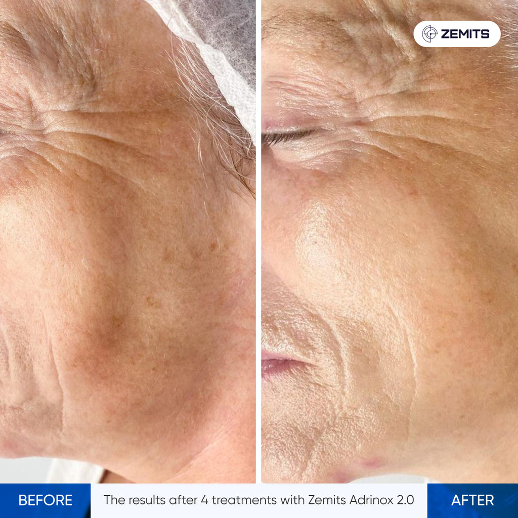 Zemits Adrinox 2.0