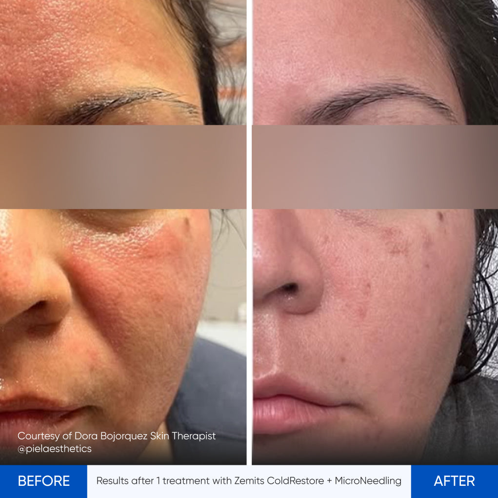Before After Slide 9