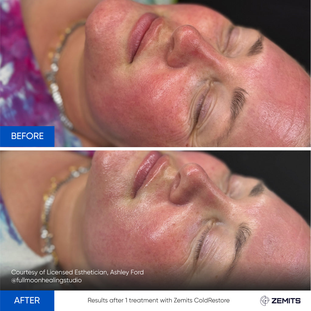 Before After Slide 20