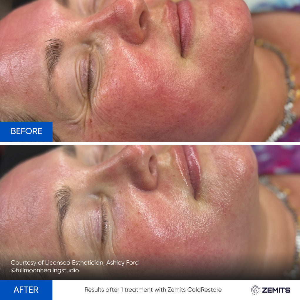 Before After Slide 21