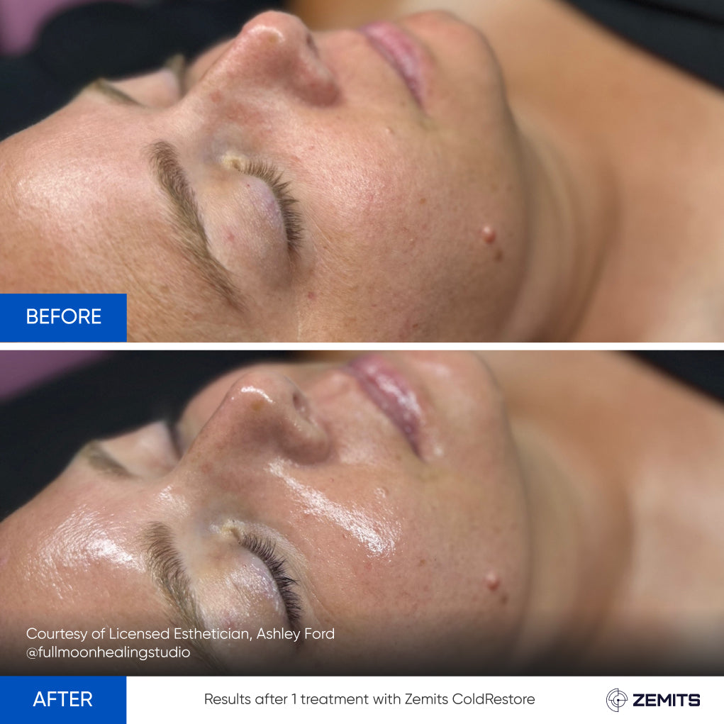 Before After Slide 22