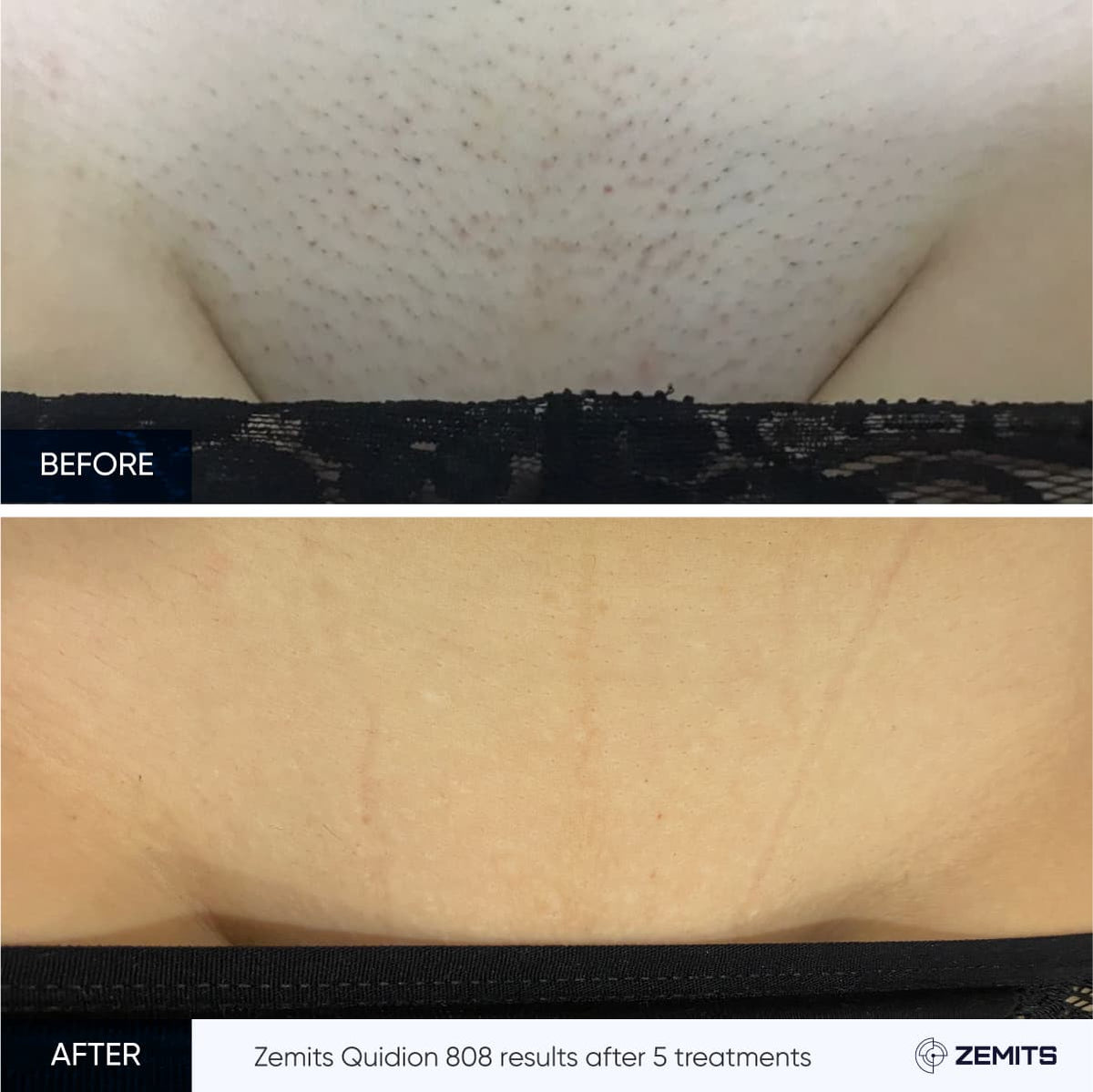 Before After Slide 13