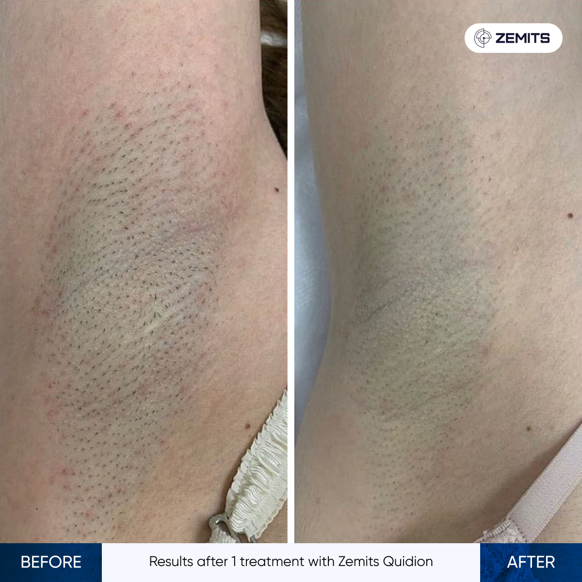 Before After Slide 14