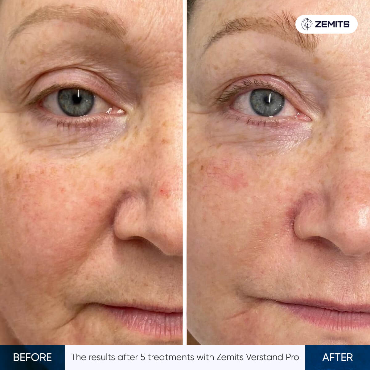 Before After Slide 16