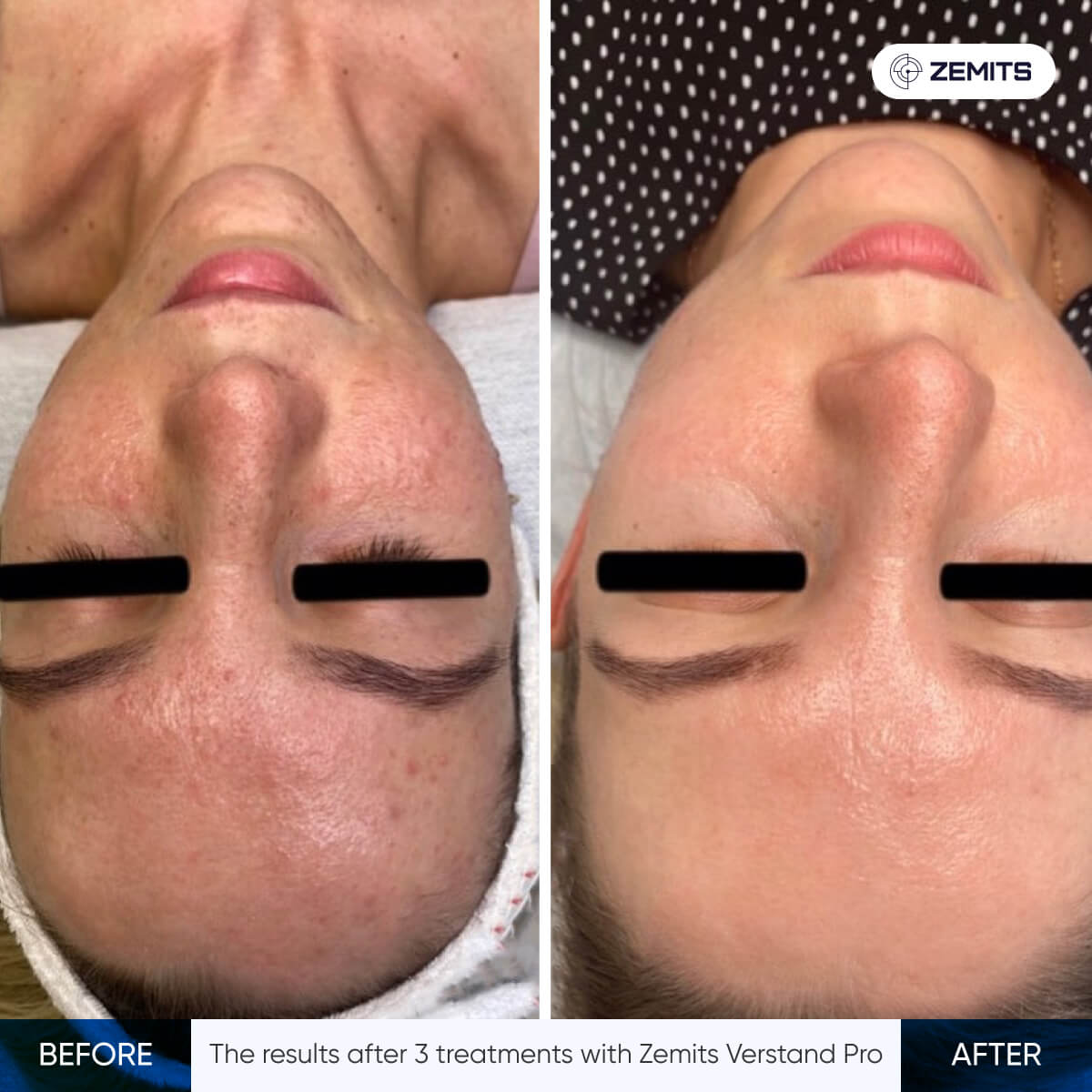 Before After Slide 14