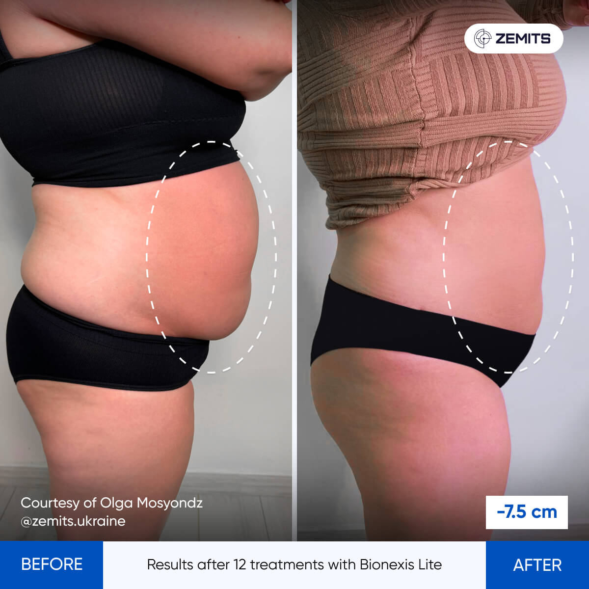 Before After Slide 1