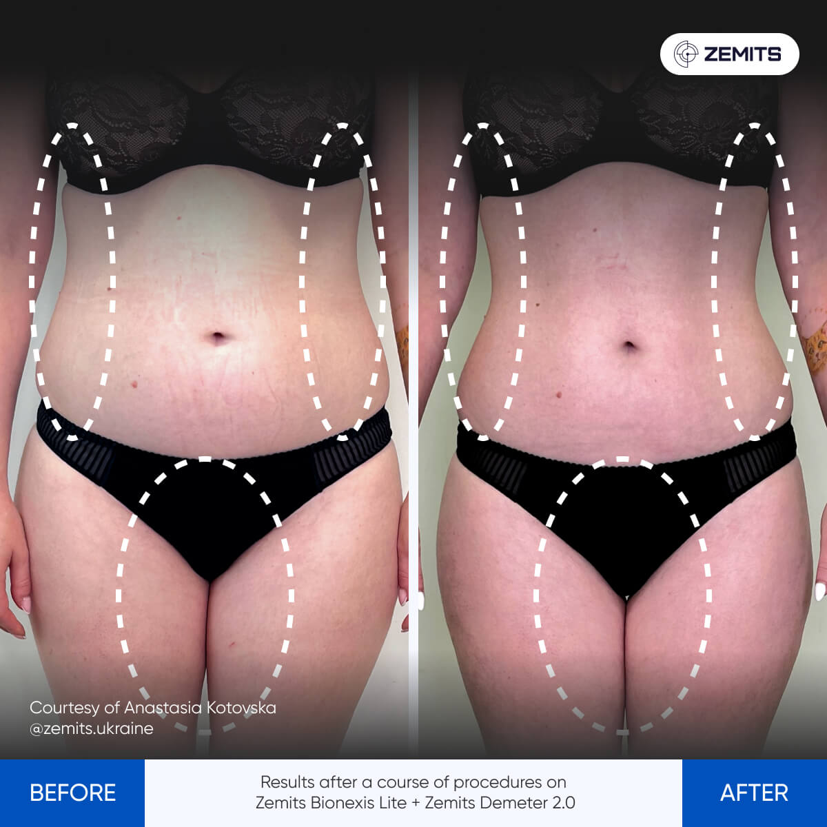 Before After Slide 4