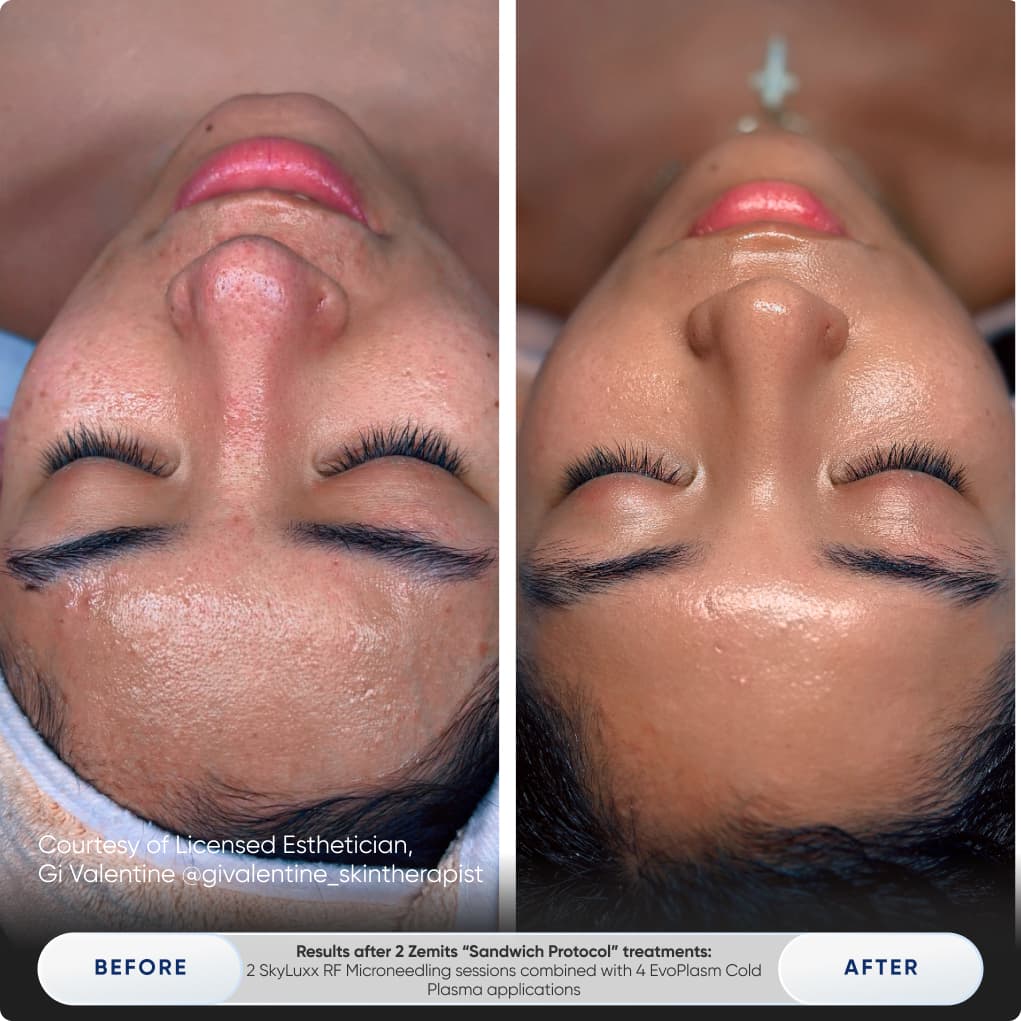 Before After Slide 5