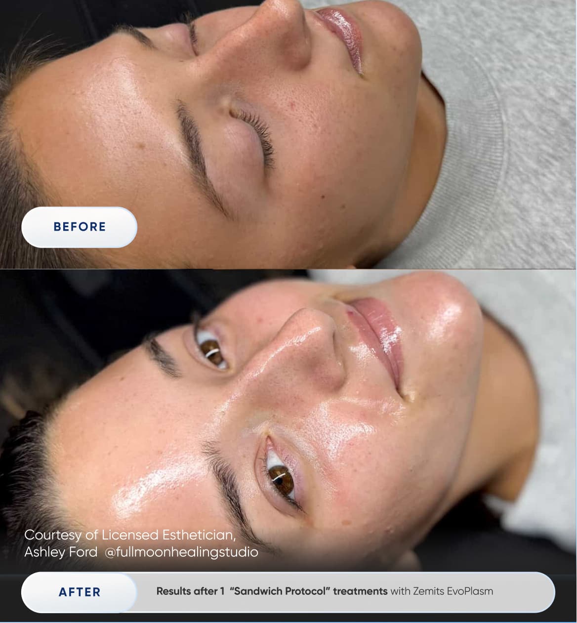 Before After Slide 2