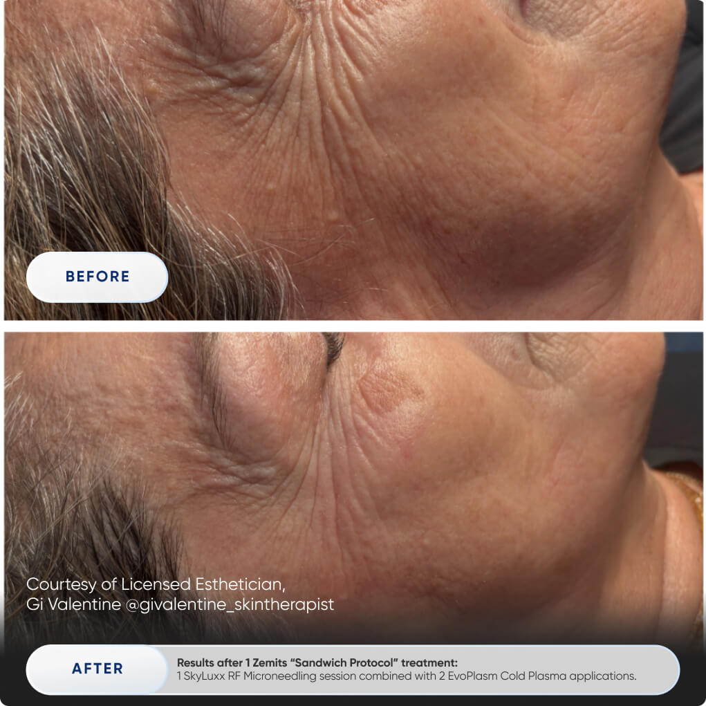 Before After Slide 4