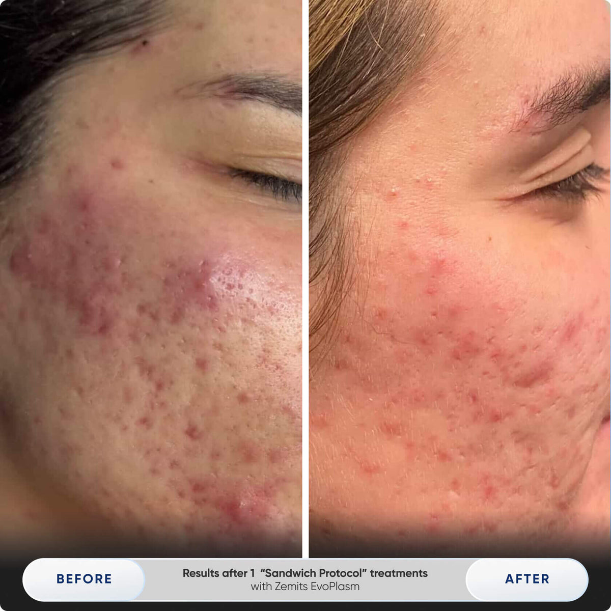 Before After Slide 7