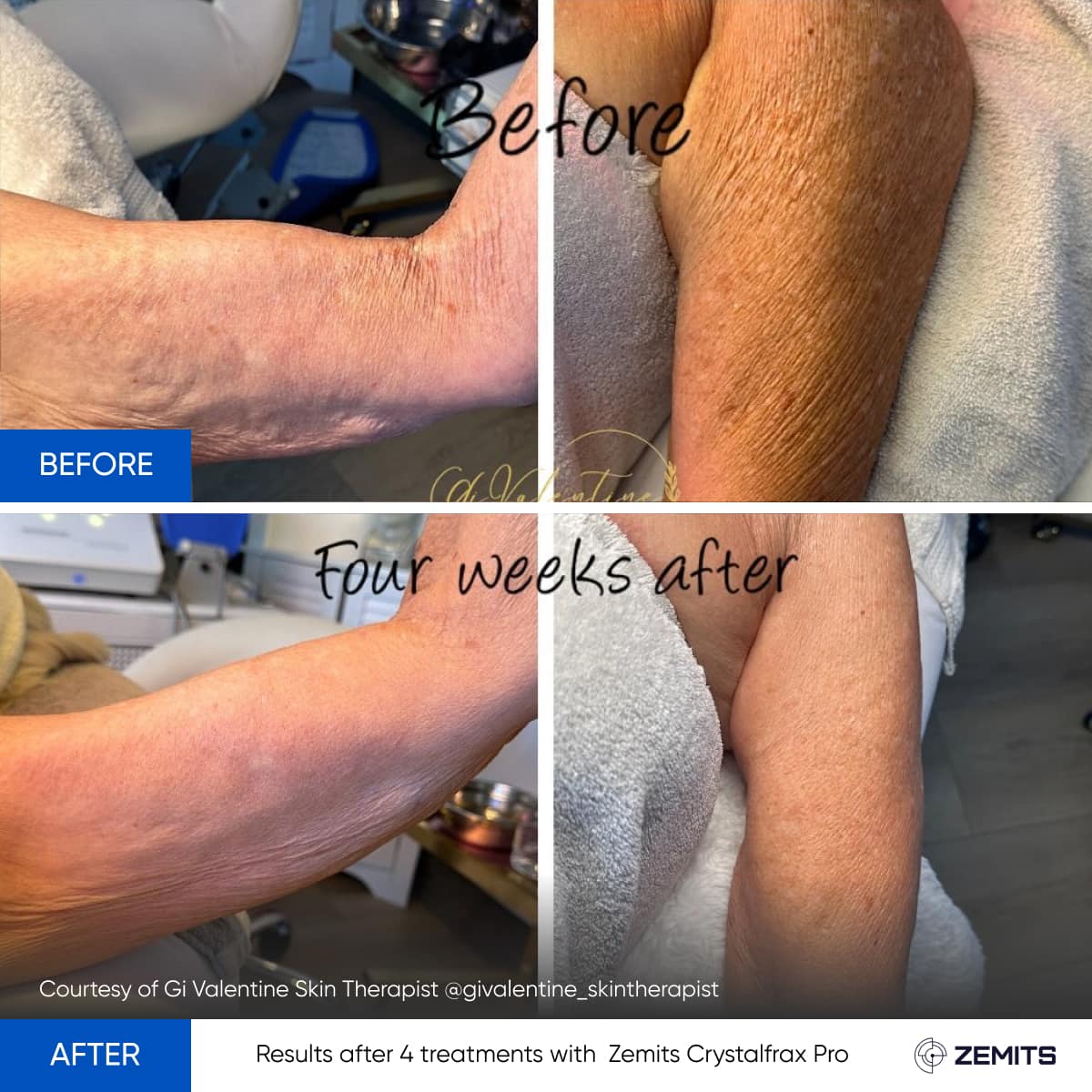 Before After Slide 2