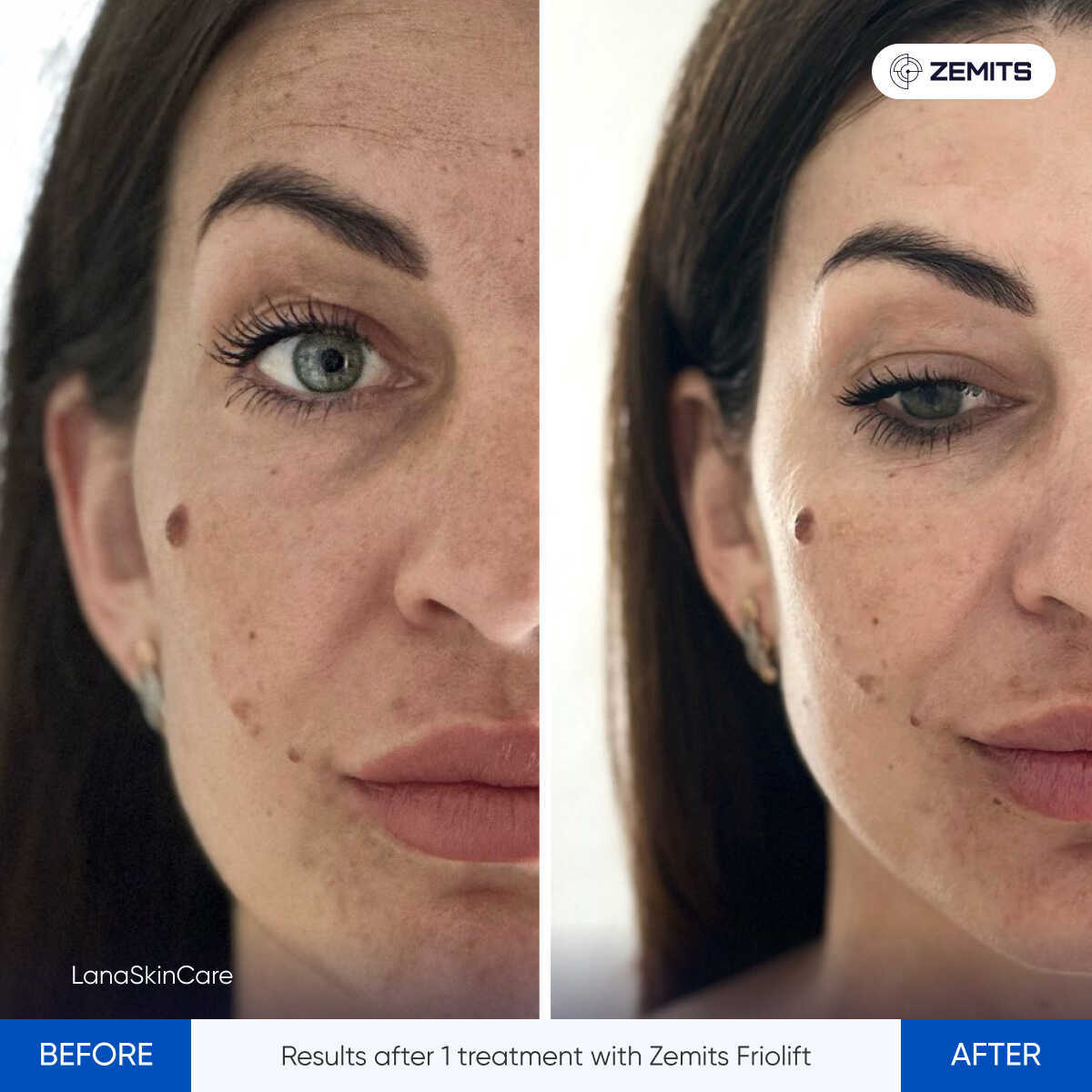 Before After Slide 10