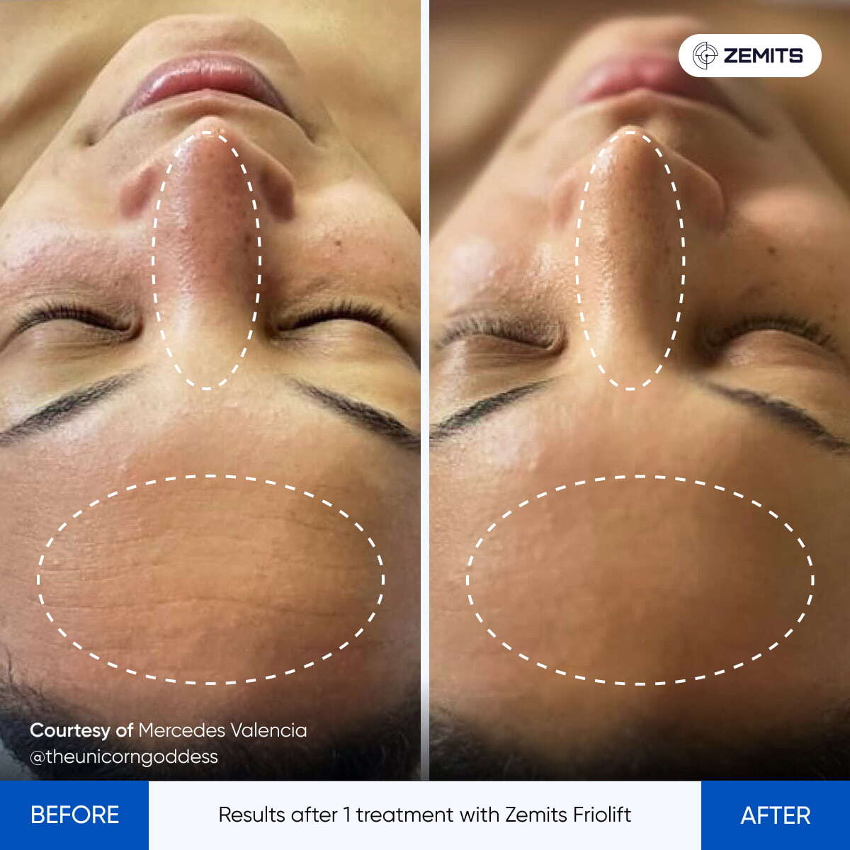 Before After Slide 21