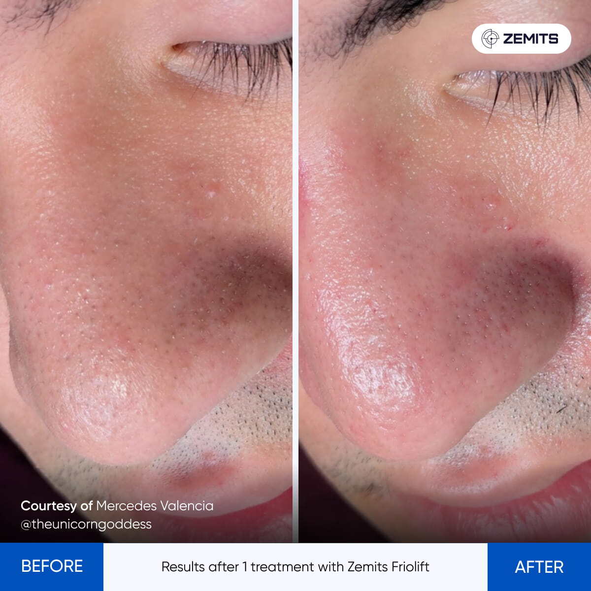 Before After Slide 22