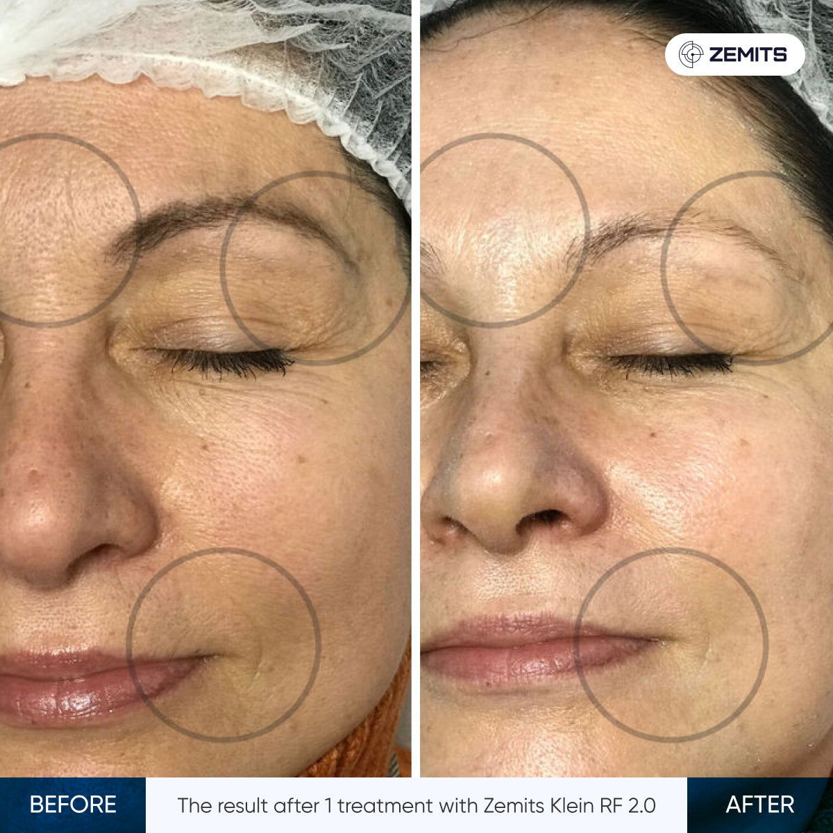 Before After Slide 1