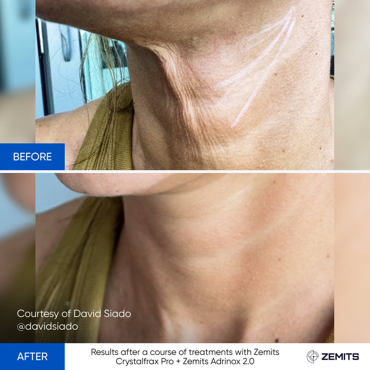 Before After Slide 2