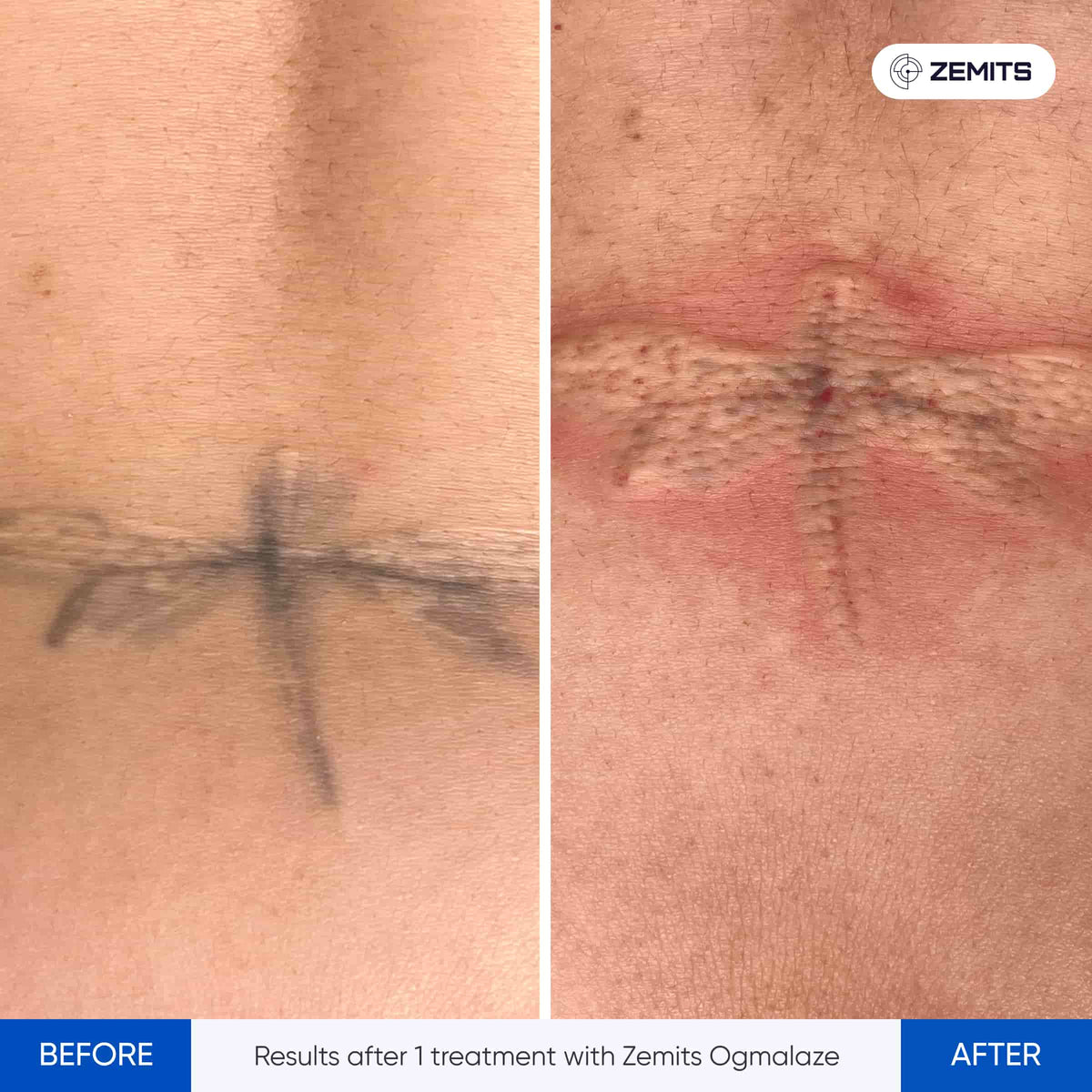 Before After Slide 1