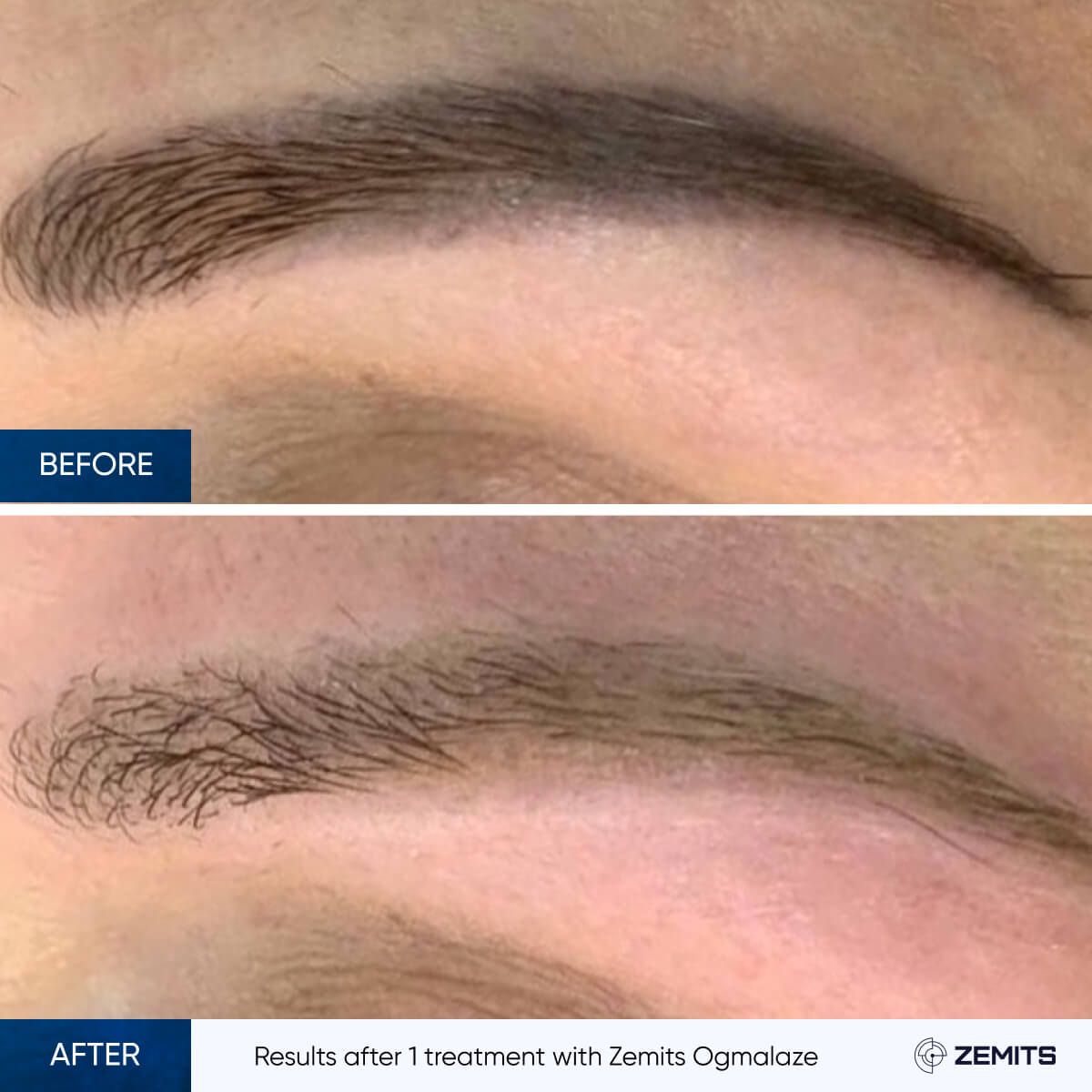 Before After Slide 3