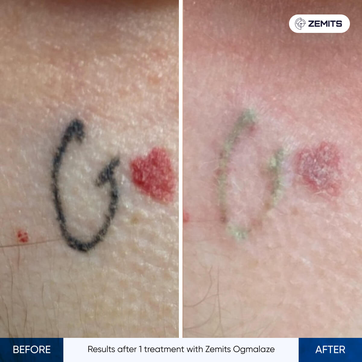 Before After Slide 4