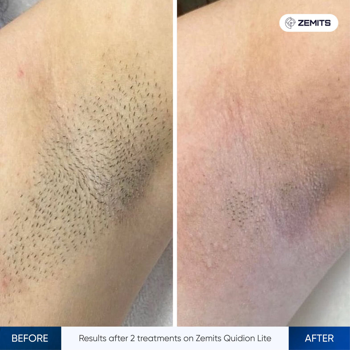 Before After Slide 2